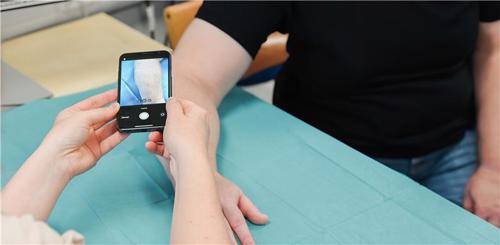 Doctor taking a picture of a patient's skin condition using the new Digital Dermatology app.