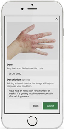 Digital Dermatology image capture